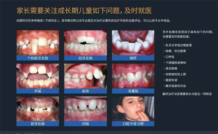 儿童牙齿早期干预矫治真的有必要吗？